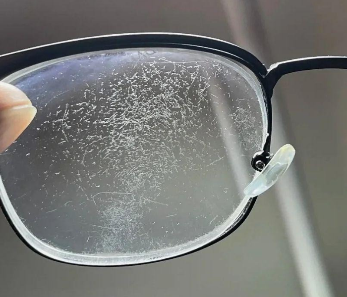 รอยตำหนิบนเลนส์